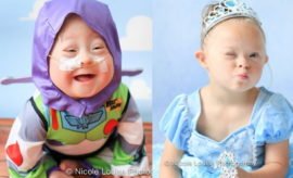 Bikin Haru, 10 Potret Anak Penderita Down Syndrom Pakai Kostum Disney Favorit